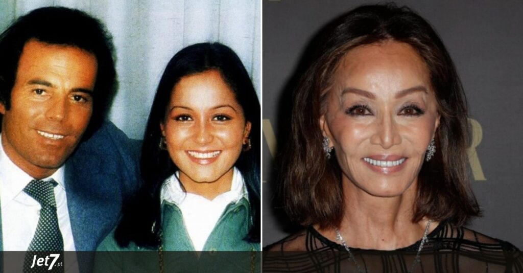 Depois de muitas plásticas e “retoques” Isabel Presley fica sem nariz. Ora VEJA!