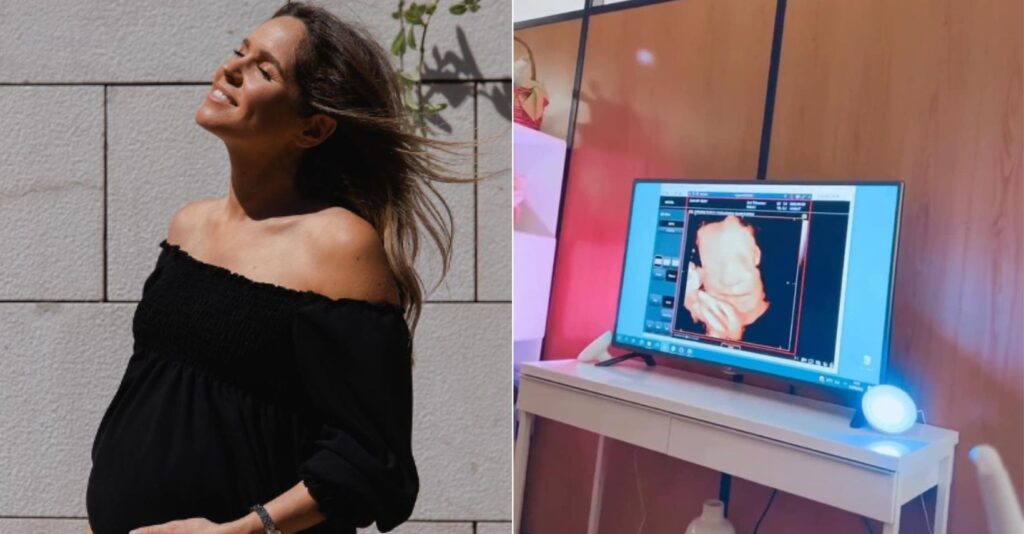 Alice Alves mostra rosto da filha em ecografia!
