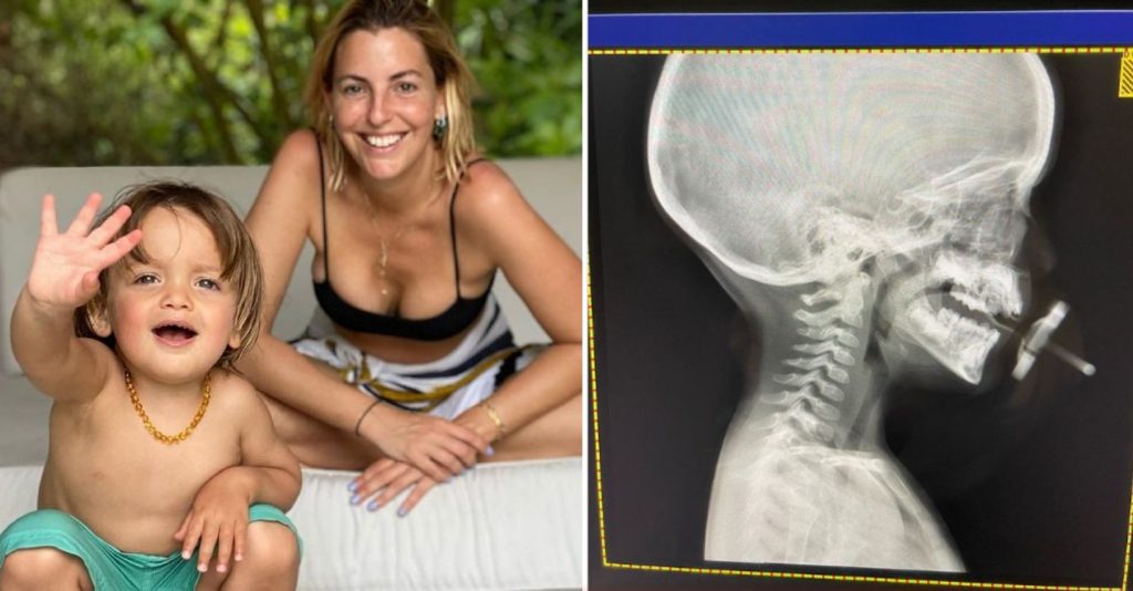 Jessica Athayde criticada após partilhar Raio-X do filho