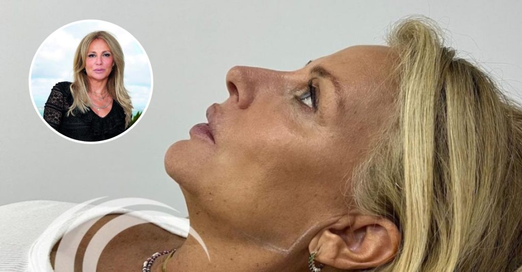 Alexandra Lencastre fez procedimentos estéticos no rosto, saiba quais!