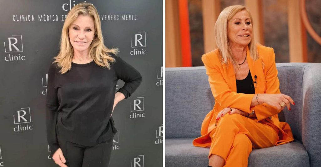 Rejuvenescimento facial de Cinha Jardim e Zulmira Ferreira feito por FALSO médico em famosa clínica!