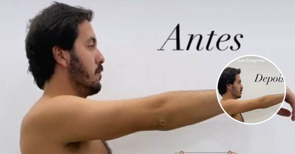 INCRÍVEL! António Bravo do Big Brother perdeu 7 Kg em apenas 20 dias, veja as fotos!