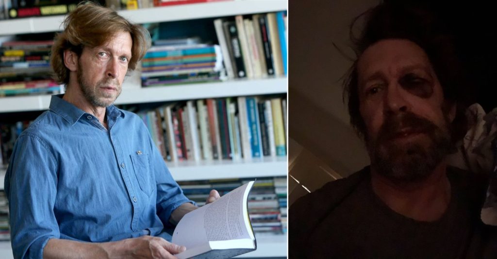 Lamentável! João Quadros é agredido após tentativa de assalto!