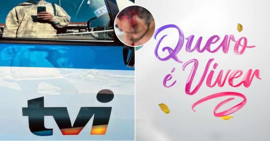 Ator da TVI é espancado e assaltado, saiba quem é, o que aconteceu e veja as fotos!