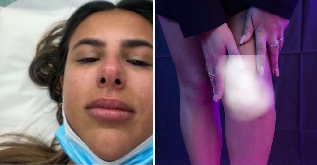 Joana Albuquerque recorda momento frágil: “Podia fazer com que perdesse a minha perna esquerda”