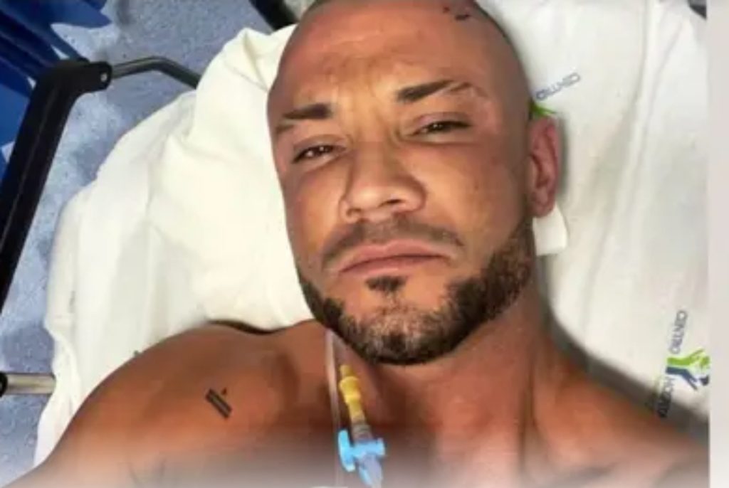 Ator Pedro Barroso sofre (forte) acidente de viação numa curva sem visibilidade a 1 minuto de casa.